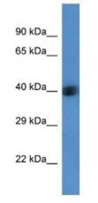 Western Blot: AGPAT3 Antibody [NBP1-74276]