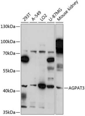 Western Blot: AGPAT3 AntibodyAzide and BSA Free [NBP2-92162]