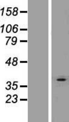 Western Blot: AGPAT3 Overexpression Lysate [NBP2-08549]