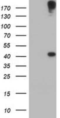 Western Blot: AGPAT5 Antibody (OTI2C4) [NBP2-01664]