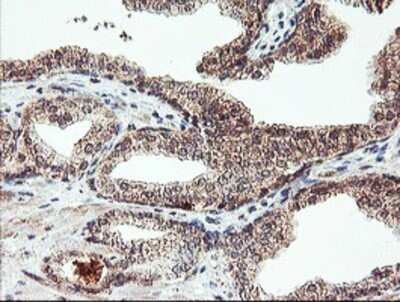 Immunohistochemistry: AGPAT5 Antibody (OTI2C4) - Azide and BSA Free [NBP2-72002]