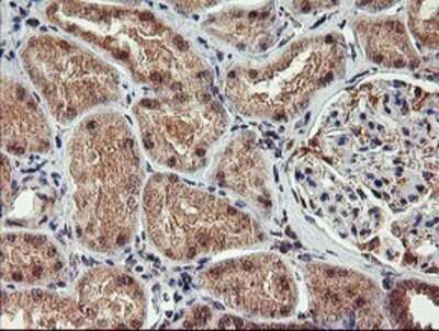 Immunohistochemistry: AGPAT5 Antibody (OTI2C4) - Azide and BSA Free [NBP2-72002]