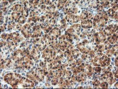 Immunohistochemistry: AGPAT5 Antibody (OTI2C4) - Azide and BSA Free [NBP2-72002]