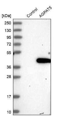 Western Blot: AGPAT5 Antibody [NBP1-83768]