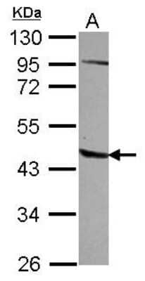 Western Blot: AGPAT5 Antibody [NBP2-15306]