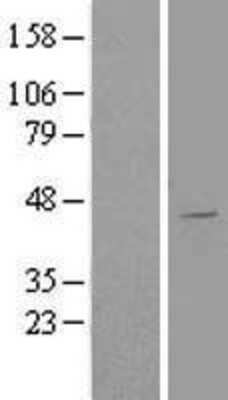 Western Blot: AGPAT5 Overexpression Lysate [NBL1-07386]