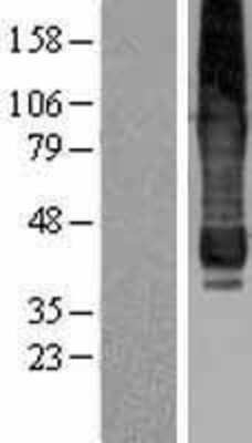 Western Blot: AGPAT6 Overexpression Lysate [NBP2-04439]