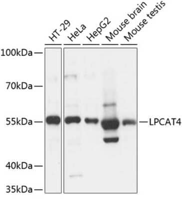 Western Blot: AGPAT7 AntibodyAzide and BSA Free [NBP2-92151]