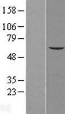 Western Blot: AGPAT7 Overexpression Lysate [NBL1-12651]