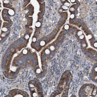 Immunohistochemistry-Paraffin: AGPAT9 Antibody [NBP1-93692]