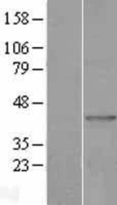 Western Blot: AGPAT9 Overexpression Lysate [NBP2-04404]