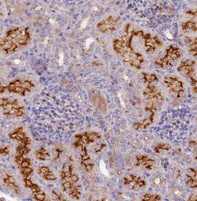 Immunohistochemistry-Paraffin: Hydroxylysine kinase Antibody [NBP1-81299]