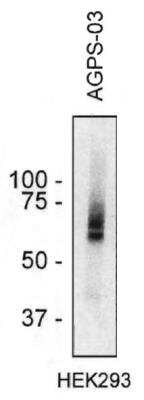 Western Blot: AGPS Antibody (AGPS-03) [NBP2-62219]