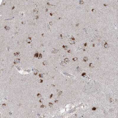 Immunohistochemistry-Paraffin: AGPS Antibody [NBP1-89240]