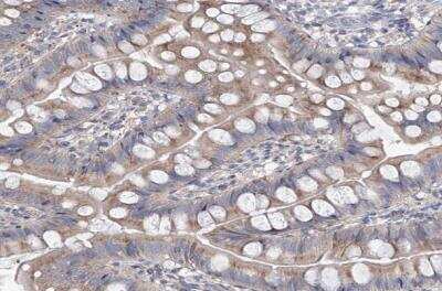 Immunohistochemistry-Paraffin: AGPS Antibody [NBP1-89241]