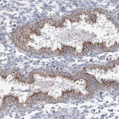 Immunohistochemistry-Paraffin: AGPS Antibody [NBP1-89241]