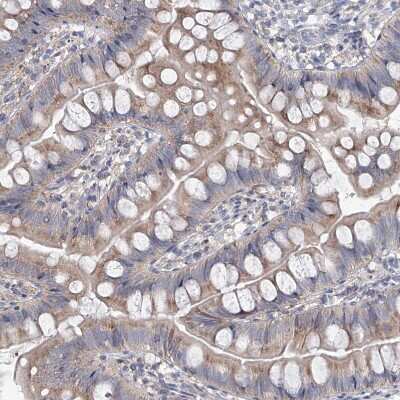 Immunohistochemistry-Paraffin: AGPS Antibody [NBP1-89241]