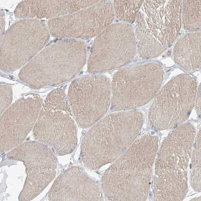 Immunohistochemistry-Paraffin: AGPS Antibody [NBP1-89241]
