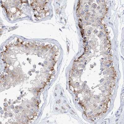 Immunohistochemistry-Paraffin: AGPS Antibody [NBP1-89241]