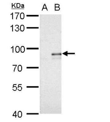 Western Blot: AGPS Antibody [NBP1-32033]