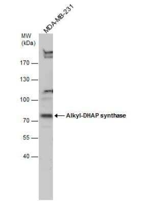 Western Blot: AGPS Antibody [NBP1-32033]