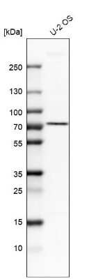 Western Blot: AGPS Antibody [NBP1-89241]