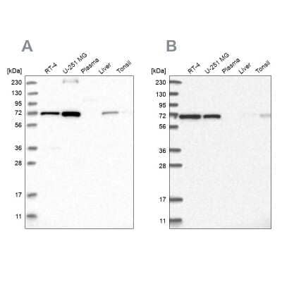 Western Blot: AGPS Antibody [NBP1-89241]