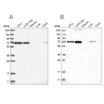 Western Blot: AGPS Antibody [NBP1-89242]