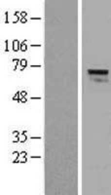 Western Blot: AGPS Overexpression Lysate [NBL1-07389]