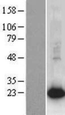 Western Blot: AG-2/AGR2 Overexpression Lysate [NBP2-07625]