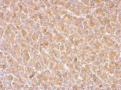 Immunohistochemistry: AG-3/AGR3 Antibody [NBP2-15307]