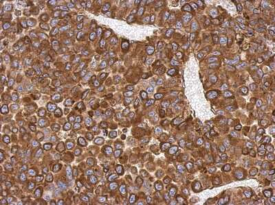 Immunohistochemistry-Paraffin: AG-3/AGR3 Antibody [NBP2-15307]