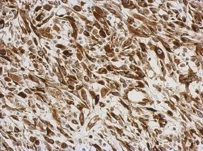 Immunohistochemistry-Paraffin: AG-3/AGR3 Antibody [NBP2-15307]