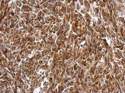 Immunohistochemistry-Paraffin: AG-3/AGR3 Antibody [NBP2-15307]
