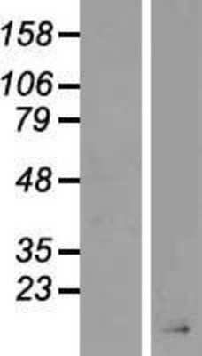 Western Blot: AgRP/ART Overexpression Lysate [NBP2-08229]