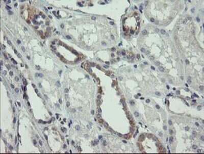 Immunohistochemistry: AGTPBP1 Antibody (OTI9A3) [NBP2-46502]