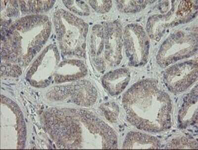 Immunohistochemistry: AGTPBP1 Antibody (OTI9A3) [NBP2-46502]