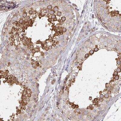 Immunohistochemistry-Paraffin: AGTPBP1 Antibody [NBP2-31662]