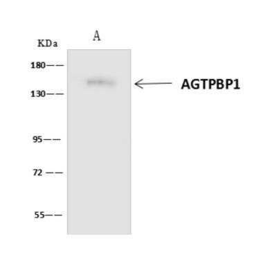 Immunoprecipitation: AGTPBP1 Antibody [NBP3-06124]