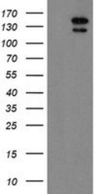 Western Blot: AGTPBP1 Antibody (OTI1C8)Azide and BSA Free [NBP2-71733]