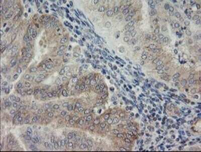 Immunohistochemistry: AGTPBP1 Antibody (OTI9A3) - Azide and BSA Free [NBP2-71734]