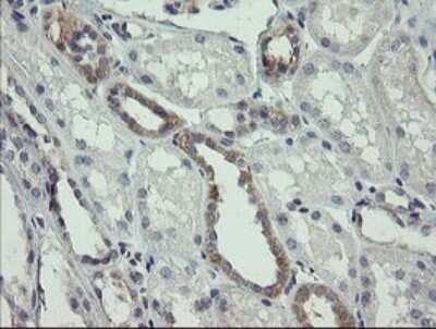 Immunohistochemistry: AGTPBP1 Antibody (OTI9A3) - Azide and BSA Free [NBP2-71734]