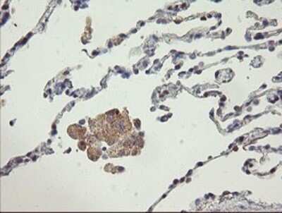 Immunohistochemistry: AGTPBP1 Antibody (OTI9A3) - Azide and BSA Free [NBP2-71734]