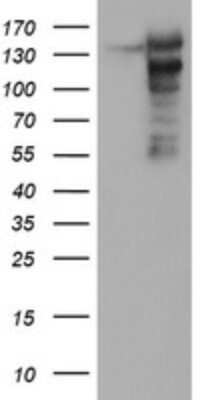 Western Blot: AGTPBP1 Antibody (OTI9A3)Azide and BSA Free [NBP2-71734]