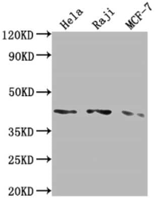 Western Blot: AGTR-1 Antibody (4A9) [NBP3-15206]