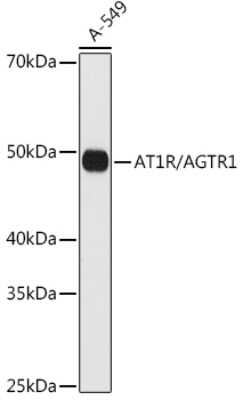 Western Blot: AGTR-1 Antibody (8W6G0) [NBP3-16341]