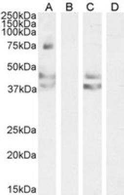 Western Blot: AGTR-1 Antibody [NB100-57073]