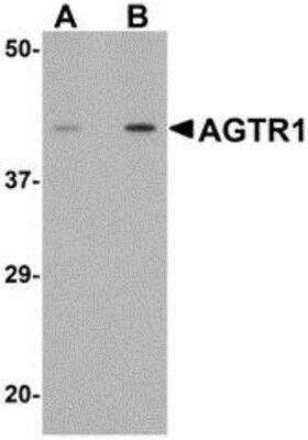 Western Blot: AGTR-1 AntibodyBSA Free [NBP1-77078]