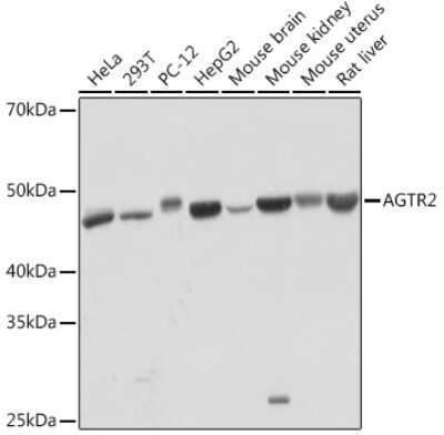 Western Blot: AGTR-2 Antibody (0V7Y3) [NBP3-16238]