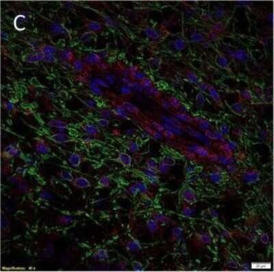 Immunohistochemistry: AGTR-2 Antibody - BSA Free [NBP1-77368]